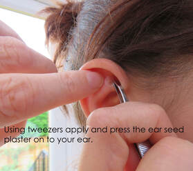 CalmPoint Ear Seed instructions showing hands with tweezers placing ear seed on shen men point on ear.